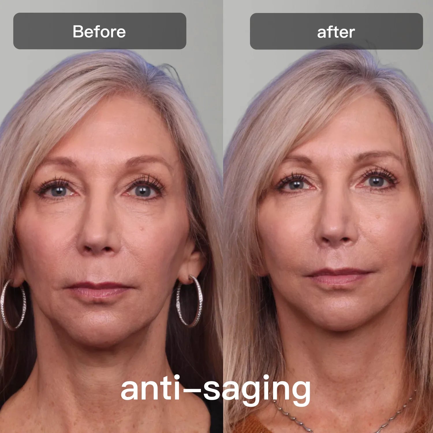 Friend Photon Skincare Device
