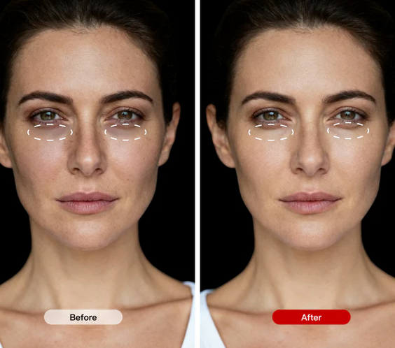 ecomposer-Options-LED-White-Face-Mask,ecomposer-Options-LED-Black-Face-Mask,ecomposer-Options-LED-White-Face-Mask-&-Nect-Set,ecomposer-Options-LED-Black-Face-Mask-&-Nect-Set